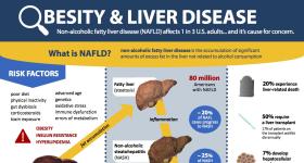 Obesity & Liver Disease infographic